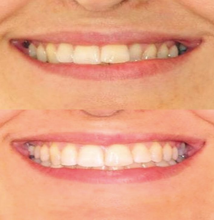 Orthodontics